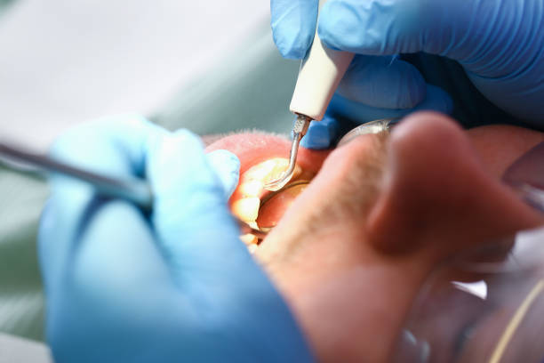Best Emergency Wisdom Teeth Removal in Luther, OK