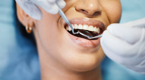 Best Emergency Dental Care for Broken or Chipped Teeth in Luther, OK